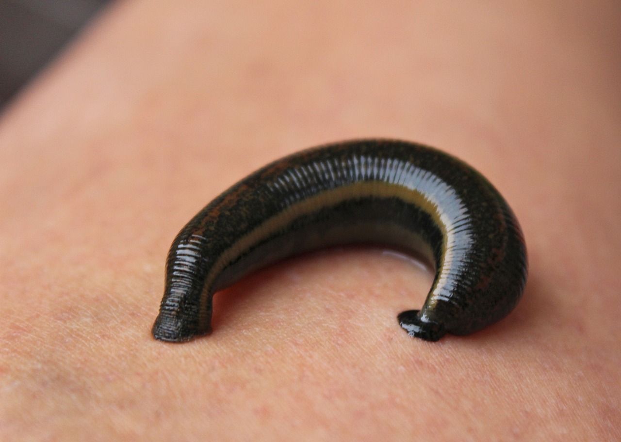 Leech Therapy in Ayurveda